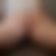 photo de spiderma3