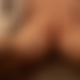 photo de spiderma3