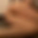 photo de spiderma3