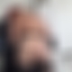 photo de culpourbites02