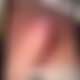 photo de xtrem