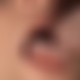 photo de facial14