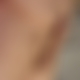 photo de grossedick