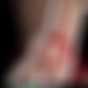photo de passifnokapot